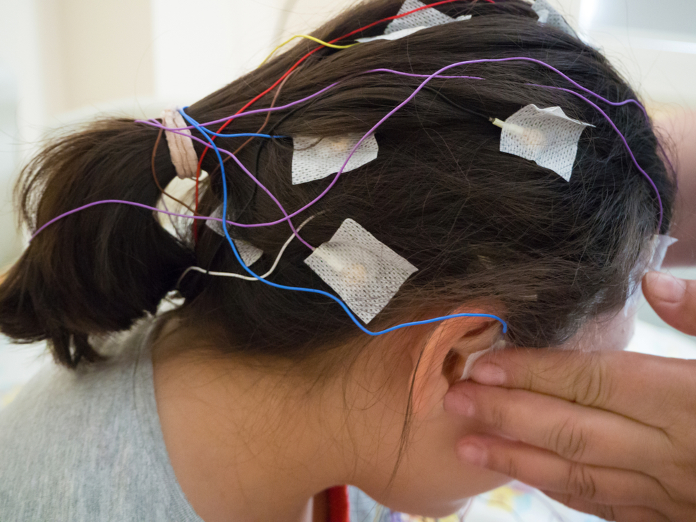 EEG tests for Measuring Brain Activity